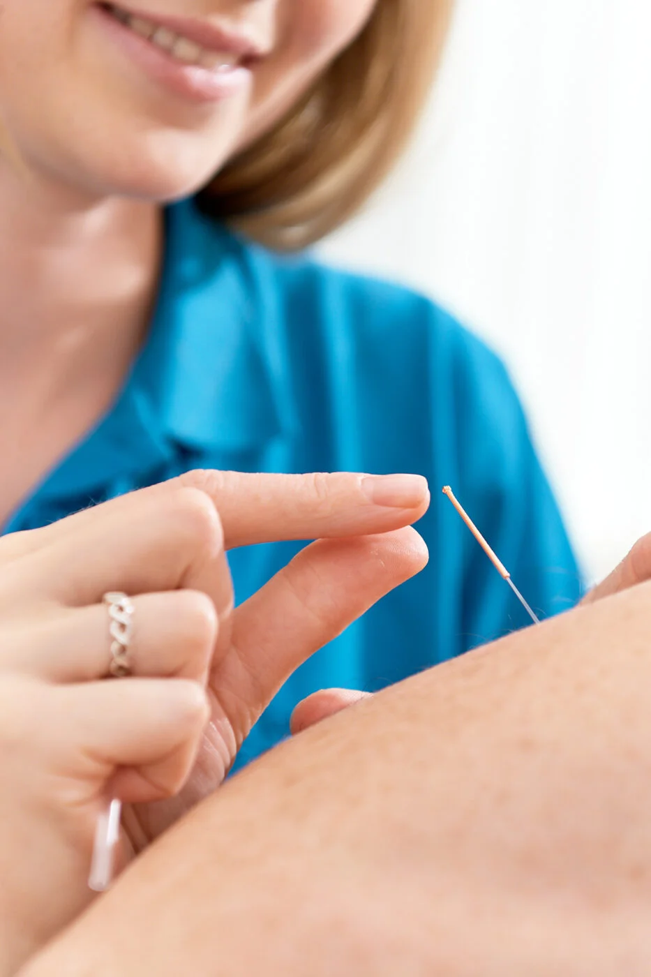 A person smiles while inserting a thin acupuncture needle into someone's skin. The person wears a blue shirt, and their fingers are gently holding the needle. Spencer Cobby